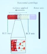 Platelet Rich Fibrin